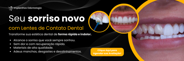 Imagem de um Banner sobre os benefícios das Lentes de Contato Dental