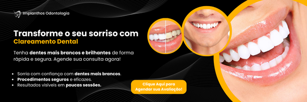 Imagem de Banner de Conversão do post sobre Clareamento Dental