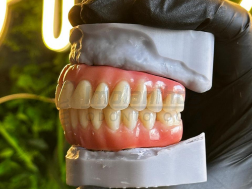 Prótese Dentária: Guia Completo em 2024