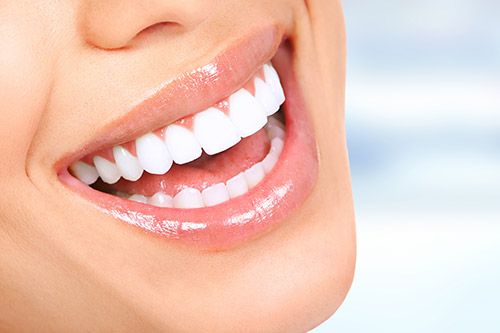 Guia Completo Sobre Clareamento Dental